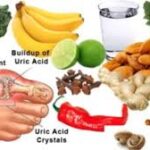 ಎಡೆಬಿಡದೆ ಕಾಡುವ ಯೂರಿಕ್‌ ಆಸಿಡ್‌, ಬರಲು  ಕಾರಣ ಮತ್ತು  ಪರಿಹಾರಗಳೇನು…